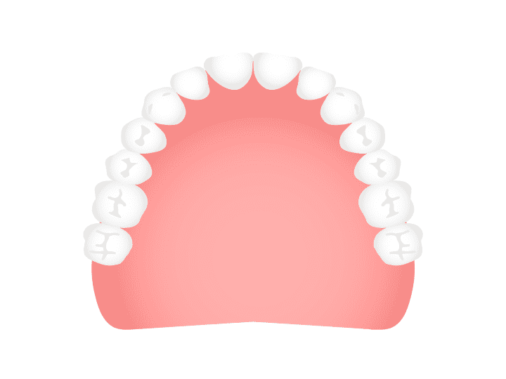 シリコンデンチャー