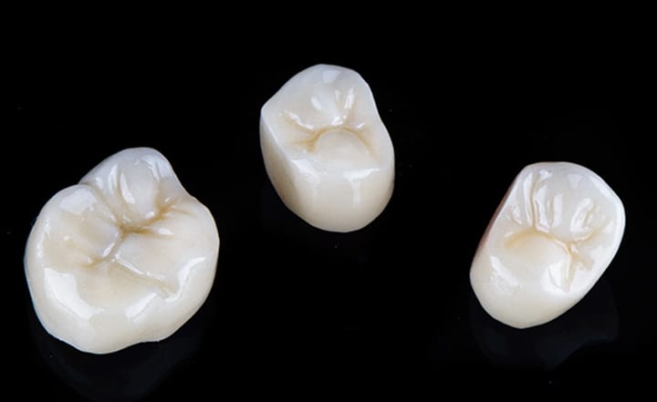 オールセラミック