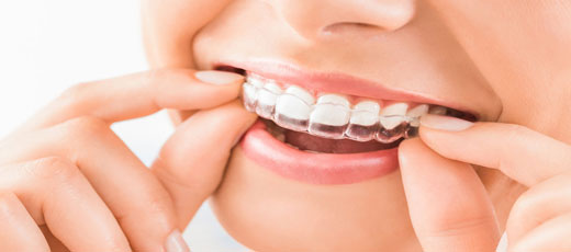 Orthodontics 矯正歯科治療